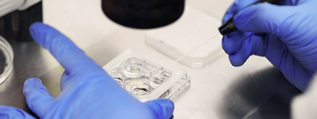 Laser Assisted Hatching - Ramkrishna IVF Centre