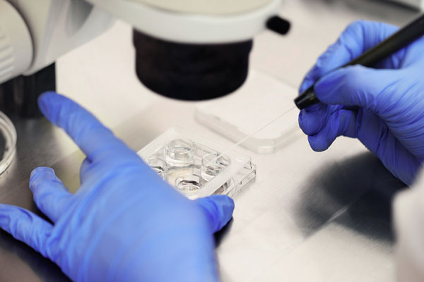 Laser Assisted Hatching