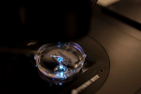 Intracytoplasmic Morphologically Sperm Injection