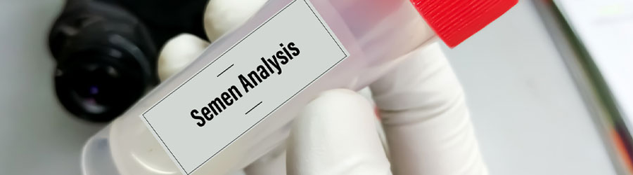 Semen Analysis